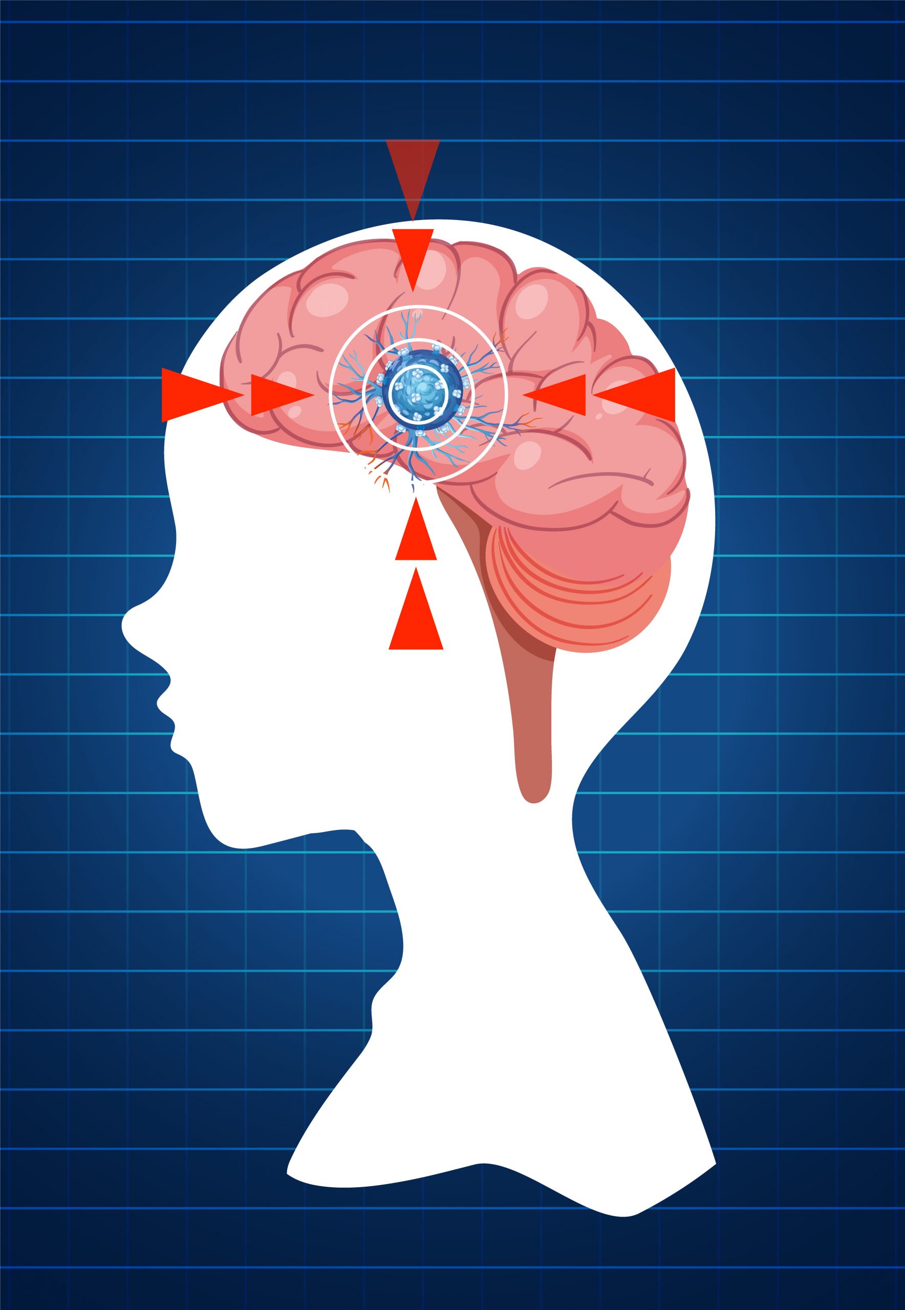 Brainmentor- how brain understand